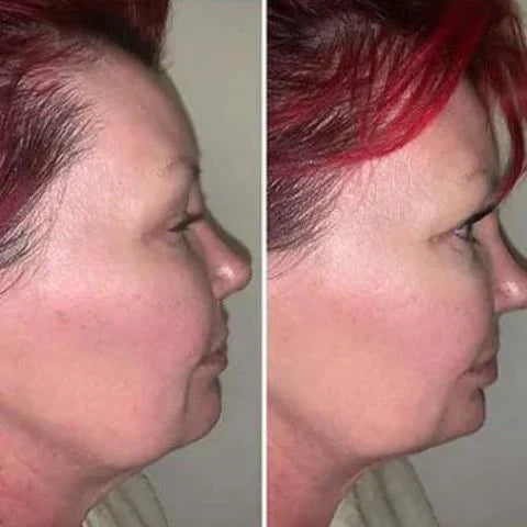 Masajeador Reductor y Rejuvenecedor Facial - RenovaSkin Pro