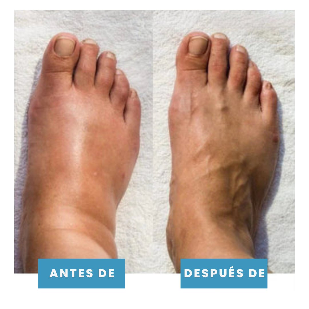 ElectroFeet™ - Revitaliza, relaja y renueva